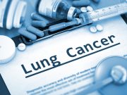 How to treat non-small lung cancer? Scientists concluded that Molecular targeted therapy and immunotherapy are the most advanced