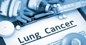 How to treat non-small lung cancer? Scientists concluded that Molecular targeted therapy and immunotherapy are the most advanced