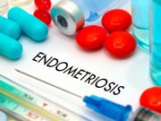 The anti-endometriosis effects of ginsenoside PPD