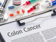 Colorectal cancer: symptoms and prevention