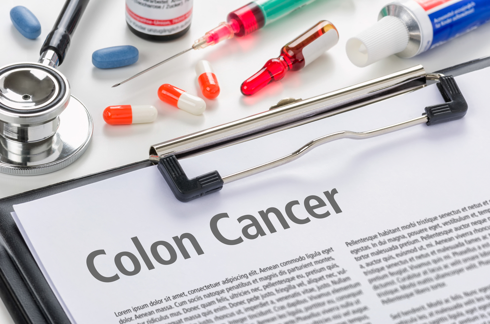 Colorectal cancer: symptoms and prevention