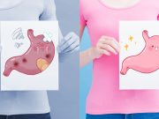 The progression from gastritis to gastric cancer and prevention measures