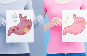 The progression from gastritis to gastric cancer and prevention measures