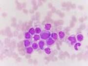 Some facts about Leukemia