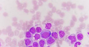 Some facts about Leukemia