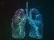 5 questions about lung cancer