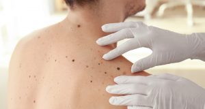 Ginsenoside Rg3 may help treat metastatic melanoma